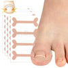 20 Pcs- Ingrown Nail Treatment Sticker