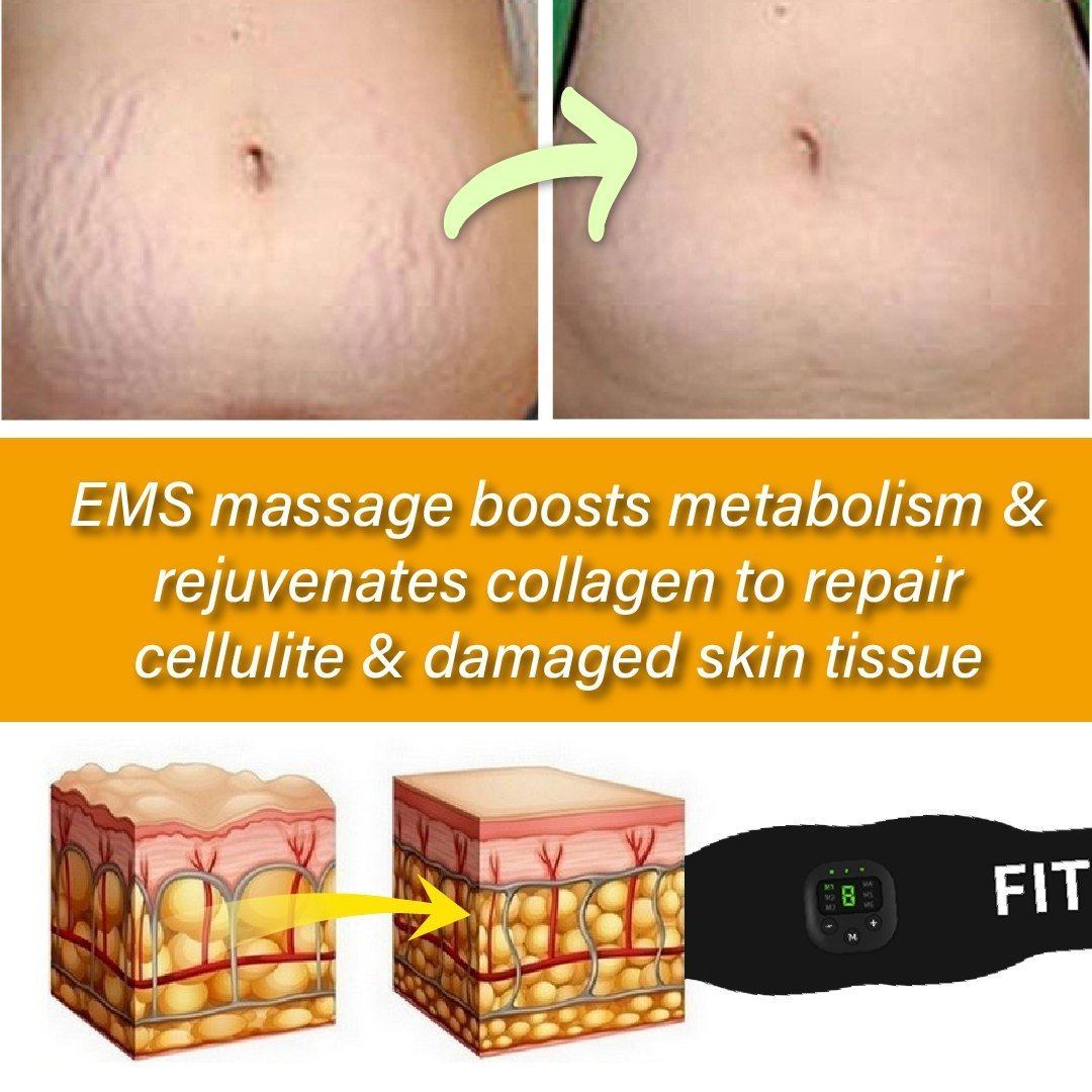 Fat & Cellulite Reduction EMS Belt