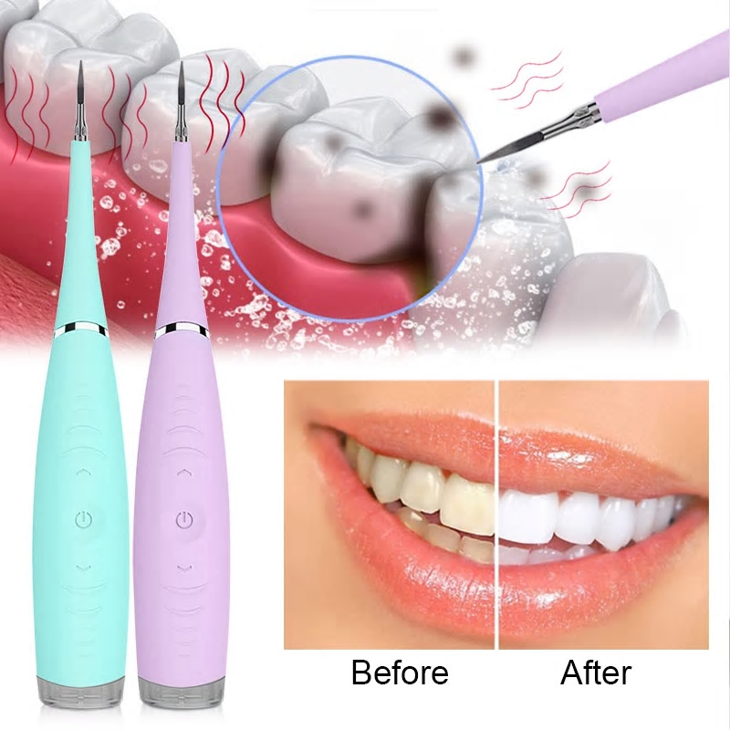 Ultrasonic Tooth Cleaning Wand